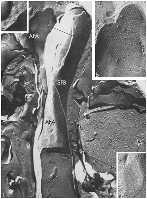 Freeze Fracture Replica Of Crayfish Abdominal Ganglion Several Axons