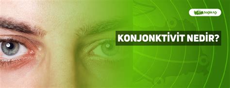 Konjonktivit Nedir Personelilan Tr