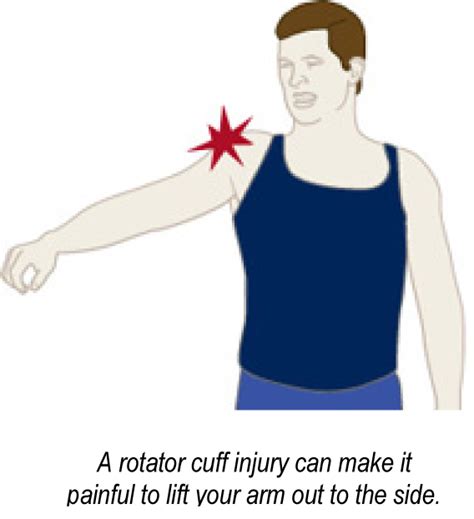 Rotator Cuff Repair Brisbane Knee And Shoulder Clinicbrisbane Knee