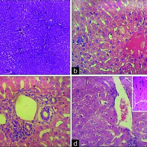 Liver Histopathology H And E Stain A Healthy Liver Tissue From A