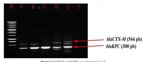 Pdf Molecular Characterization Of Carbapenemase Producing