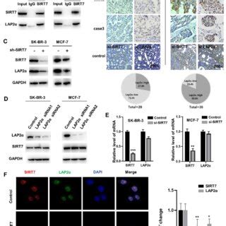 Knockdown Of Sirt Promotes Breast Cancer Cell Metastasis By