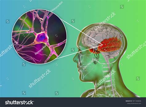 Human Brain Highlighted Temporal Lobe Closeup Stock Illustration