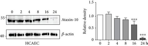 Expression Of Ataxin In Endothelial Cells A Representative Images