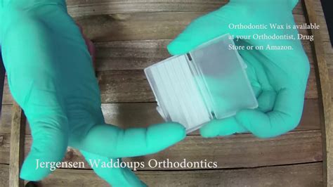 Using Orthodontic Wax To Help With Pokey Wires On Braces Youtube