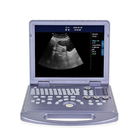 Ltub V High End Pc Based Laptop Bw Ultrasound Scanner Machine For