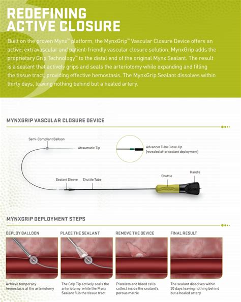 Cordis Mx6721 Mynxgrip® Vascular Closure Device 6fr 7fr Femoral