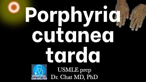 Porphyria Cutanea Tarda Pathway