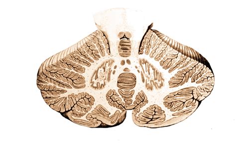 Autosomal Dominant Cerebellar Ataxia Deafness And Narcolepsy Storymd