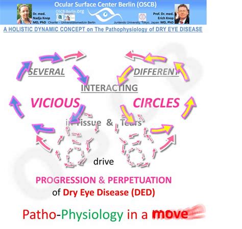 Dry Eye Concept 7 Vicious Circles — Ocular Surface Center Berlin
