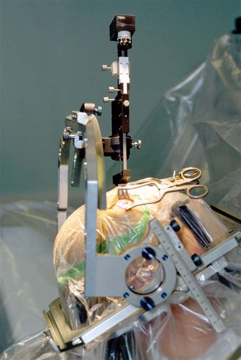 Deep Brain Stimulation DBS Britannica