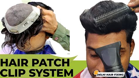 Hair Patch Clip System Hair Patch Clipping System For Men In Delhi Permanent Hair Patch