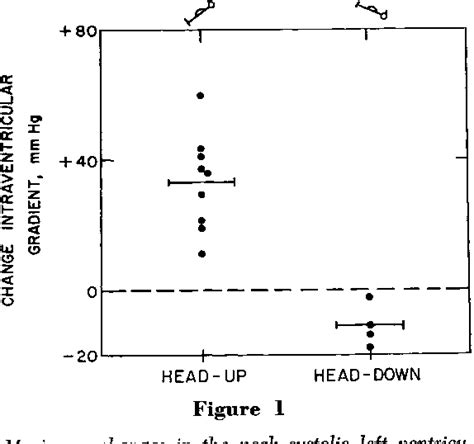 Idiopathic Hypertrophic Subaortic Stenosis Semantic Scholar