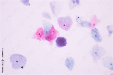 Image From Microscopic Of Herpes Simplex Virus Infection Show Ground