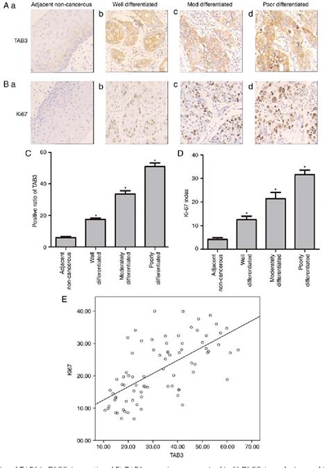 Figure 1 From TAB 3 Promotes Human Esophageal Squamous Cell Carcinoma