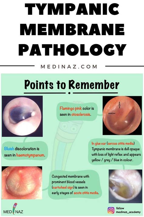 Tympanic Membrane Colour Changes And Associated Conditions Diagnostic