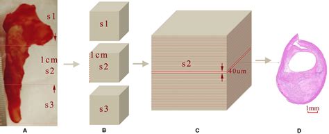 Frontiers Atherosclerotic Plaque Tissue Characterization An OCT