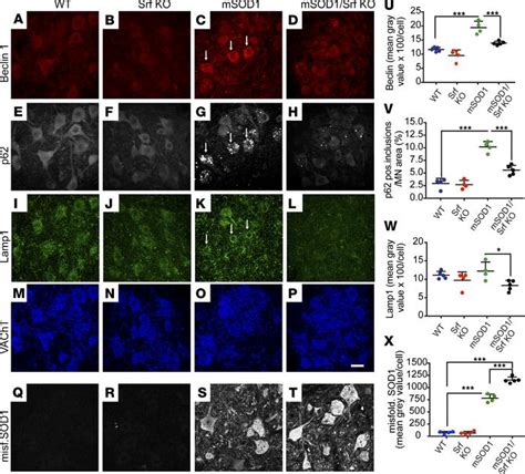 Jci Insight Srf Deletion Results In Earlier Disease Onset In A Mouse