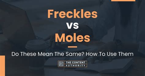 Freckles Vs Moles Do These Mean The Same How To Use Them