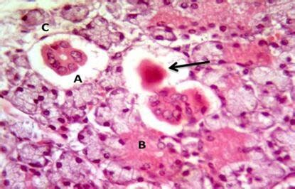 A Section Of A Submandibular Salivary Gland Of A Rabbit Of Group 2