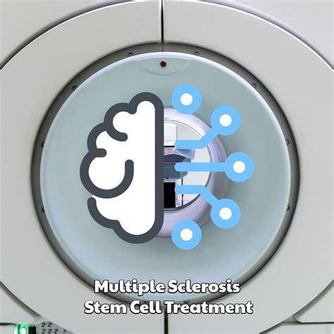 Multiple Sclerosis Stem Cell Treatment Dreambody Clinic