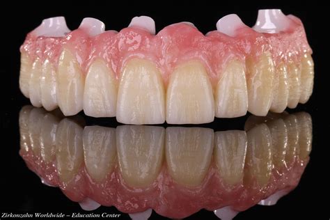 Transforming Dental Care With Digital Dentistry Pd Ceramics