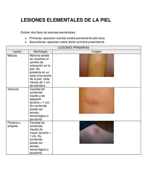 Temario Dermatologia Enarm Lesiones Elementales De La Piel Existen