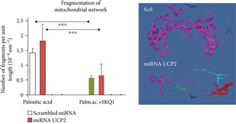 Prevention Of Palmitic Acid Induced Mitochondrial Network Fragmentation