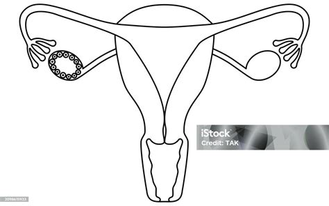 Diagrammatic Illustration Of Polycystic Ovary Syndrome Anatomy Of The