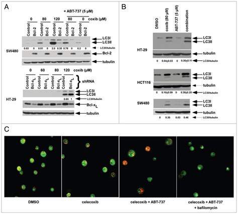 Celecoxib Induced Autophagy Can Be Negatively Regulated By Bcl 2 Bcl X