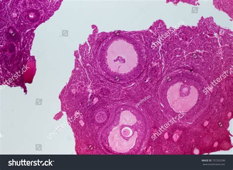 Cross Section Human Ovary Under Microscope Stock Photo 737292598