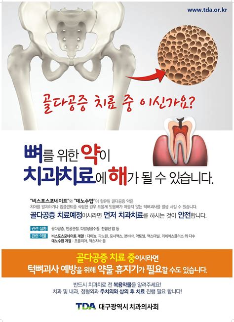 골다공증 골다공증 약 또는 주사를 맞으시나요 치과치료 전 주의