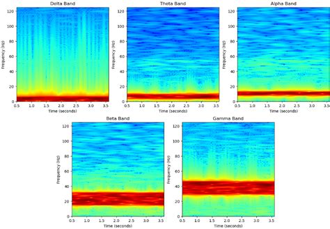 Spectrogram Of Delta Theta Alpha Beta And Gamma Frequency Bands