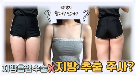 지방추출주사 💪🏻팔뚝지흡 성공하고 🔥이번엔 허벅지도전🤔 팔뚝지방흡입 팔뚝지흡 Youtube