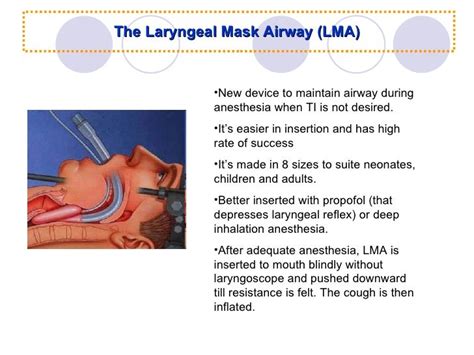 Airway Management