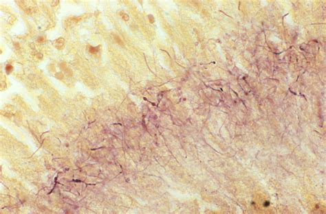 Public Domain Picture This Brown And Brenn Stained Tissue Specimen