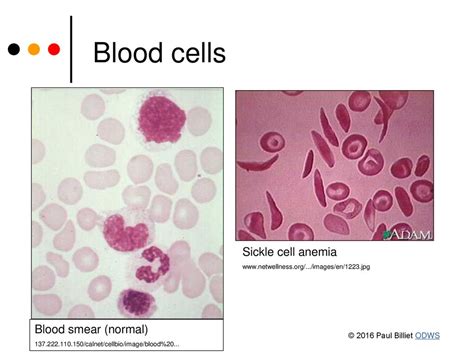 CODOMINANCE Some Genes Have Alleles That Are Both Expressed In The