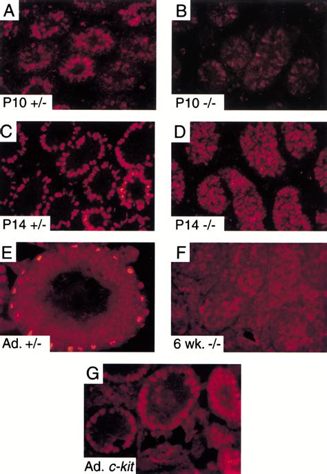 Dmrt A Gene Related To Worm And Fly Sexual Regulators Is Required