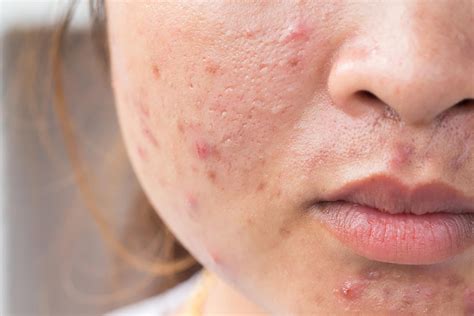 Signs Your Skin Products Are Bad for Your Skin | The Healthy