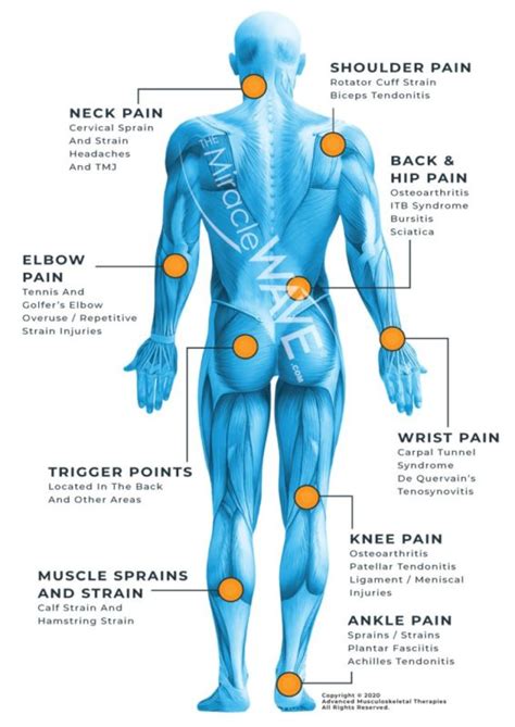 Acoustic Shockwave Therapy Miracle Wave - FYZICAL Therapy & Balance Centers