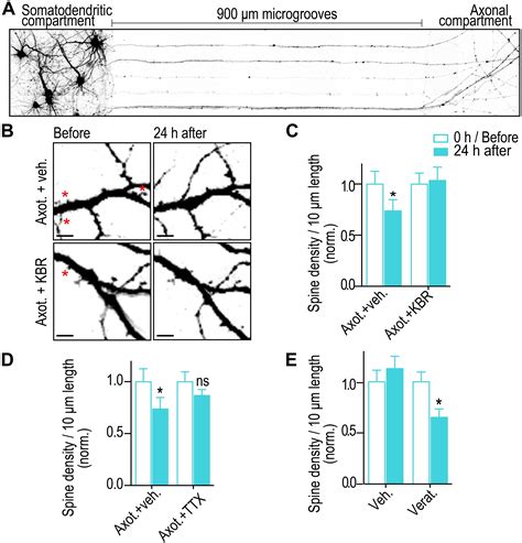 Frontiers Unique Axon To Soma Signaling Pathways Mediate Dendritic