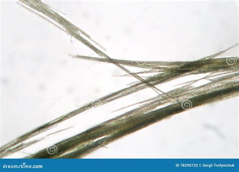 Chara Microscope Slide