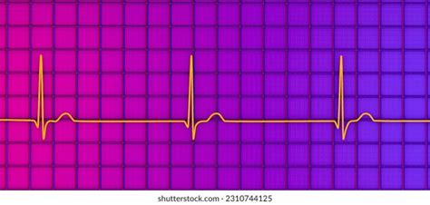 Junctional Rhythm Photos Et Images