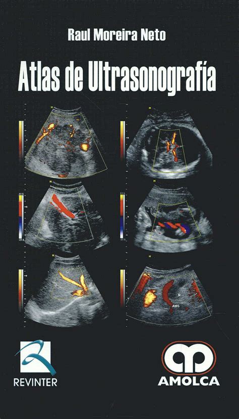 Atlas De Ultrasonografia MEDILIBRO