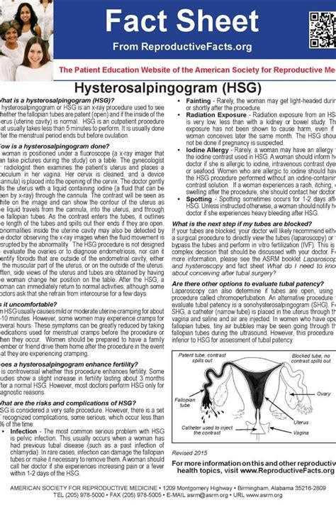 Hysterosalpingogram Hsg Fact Sheet Patient Education Fallopian Tubes