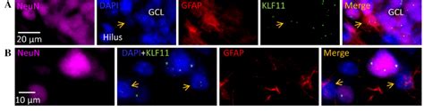 Nuclear Localization Of Klf11 In Neurons And Astrocytes Klf11 Download Scientific Diagram