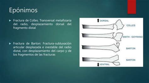 Fracturas Del Radio Distal Totalpptx