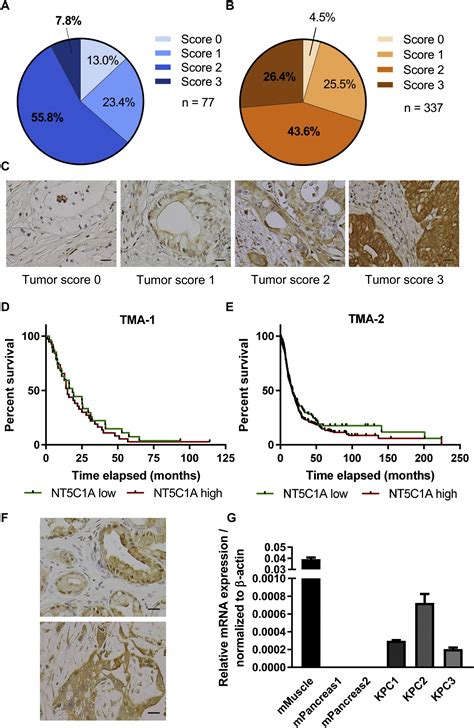 Cytosolic 5′ Nucleotidase 1a Is Overexpressed In Pancreatic Cancer And