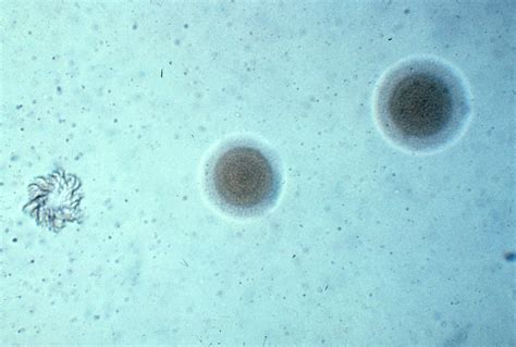 b642-4 Mycoplasma pneumoniae. Photomicrograph, unstained. … | Flickr