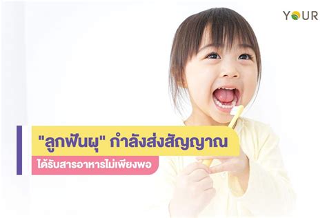 ลูกฟันผุ สัญญาณบอกว่าได้รับสารอาหารไม่เพียงพอ Your